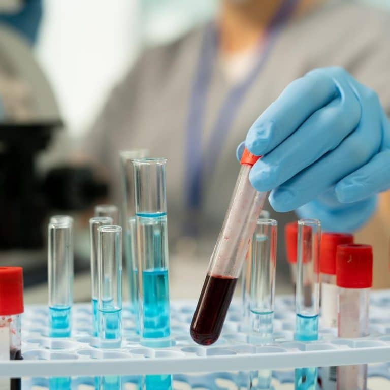 examining-blood-sample-in-laboratory-2021-09-24-03-41-13-utc_c examining-blood-sample-in-laboratory-2021-09-24-03-41-13-utc_c